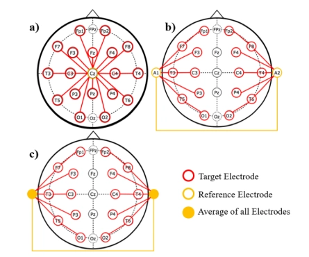 eeg