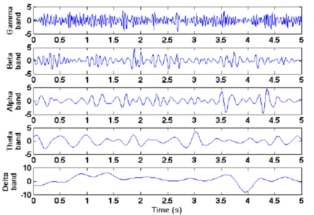 EEG Filtering