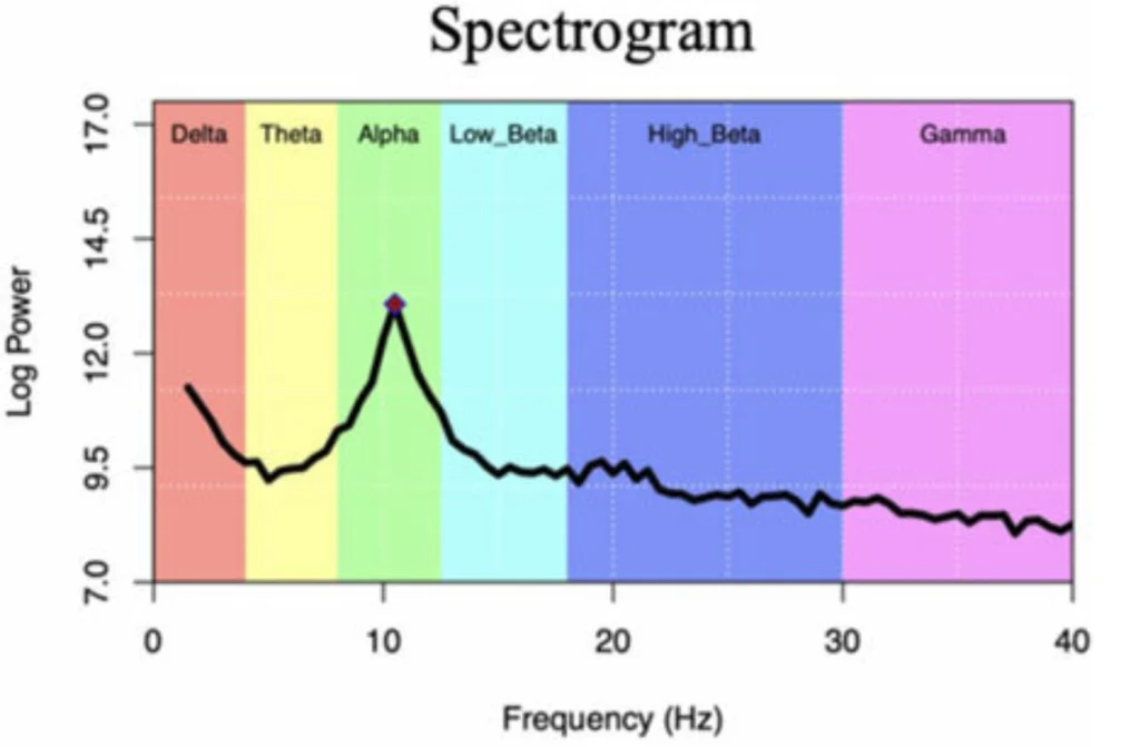 eeg