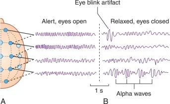 eeg