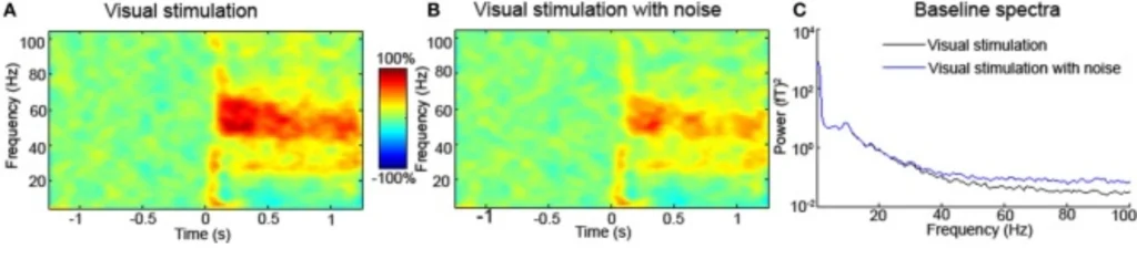 EEG Filtering
