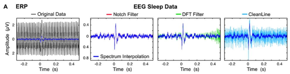 EEG Filtering