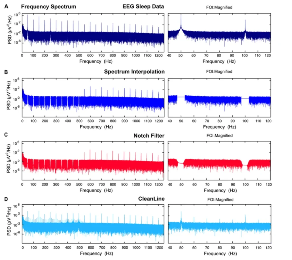 EEG Filtering